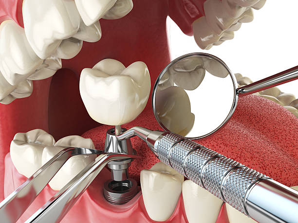 Reliable TN Emergency Dental Service Solutions